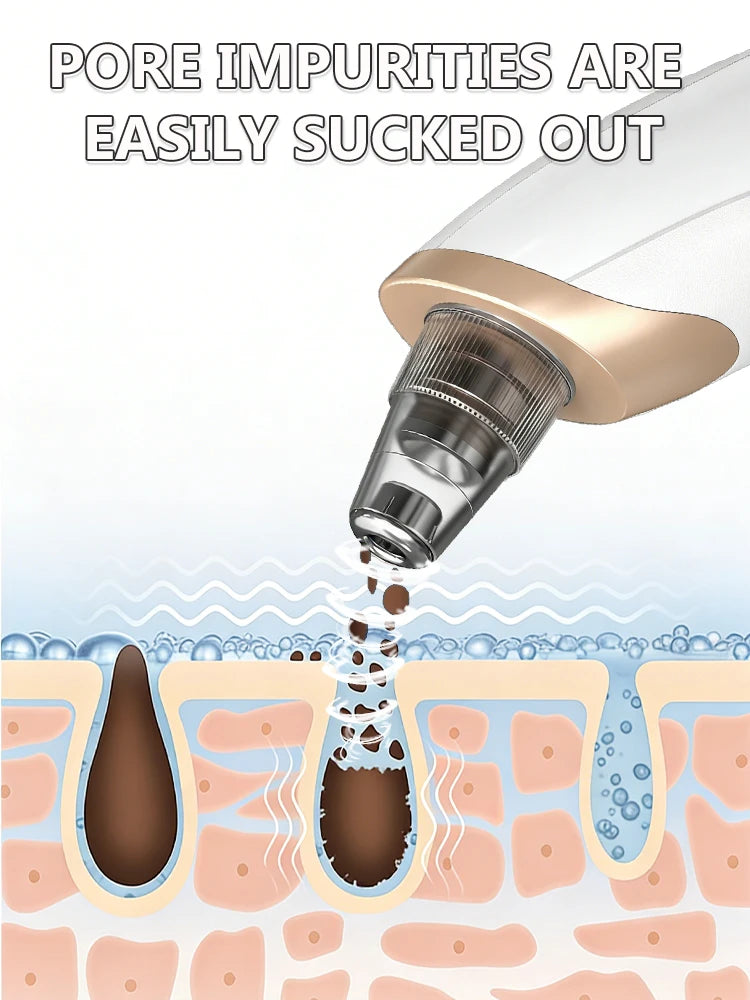 Blackhead Remover – Pore Cleansing Facial Massage Tool
