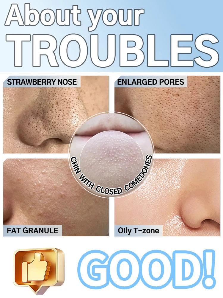 Blackhead Remover – Pore Cleansing Facial Massage Tool