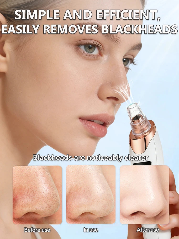 Blackhead Remover – Pore Cleansing Facial Massage Tool