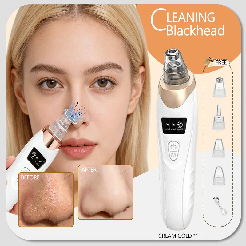Blackhead Remover – Pore Cleansing Facial Massage Tool