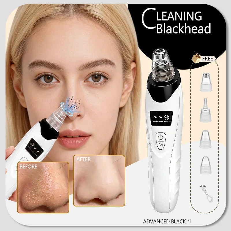 Blackhead Remover – Pore Cleansing Facial Massage Tool