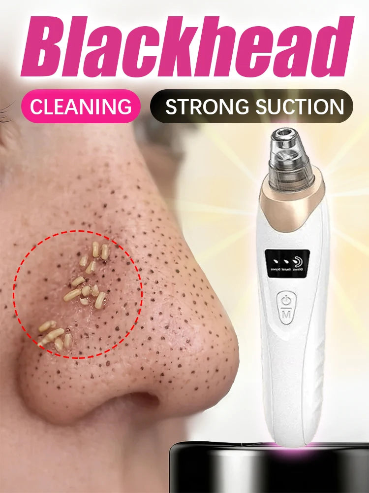 Blackhead Remover – Pore Cleansing Facial Massage Tool